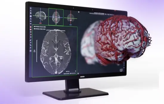 Avatar Medical Eonis Vision